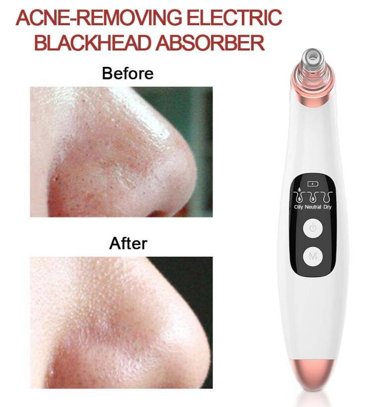 USB Electric Blackhead Remover