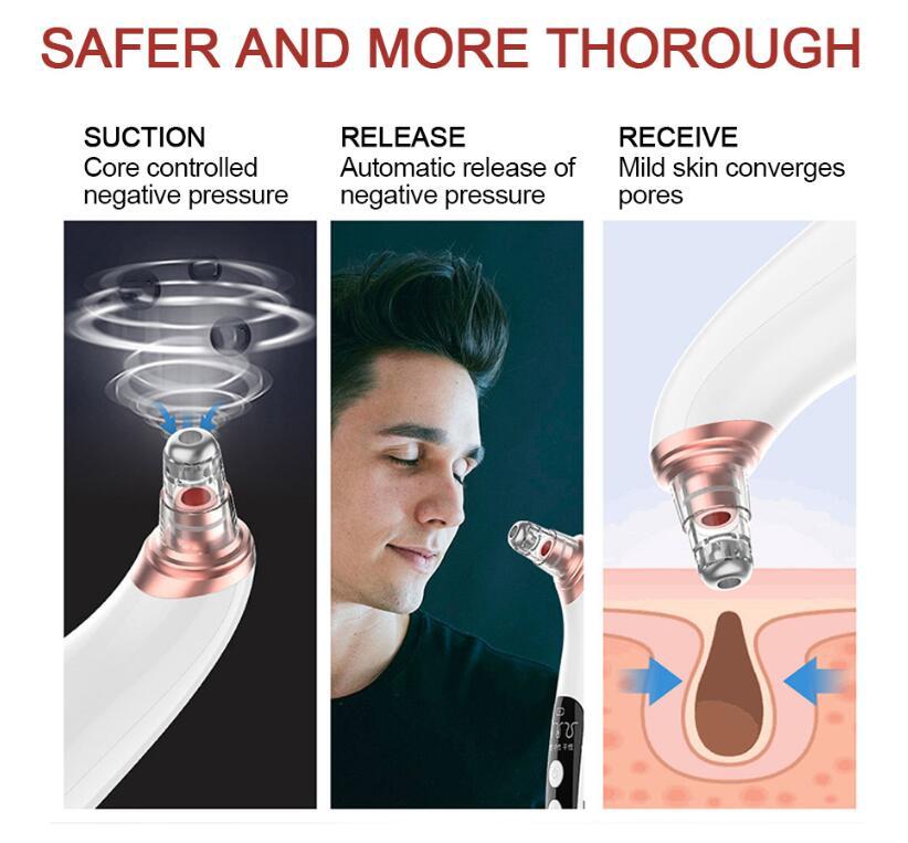 USB Electric Blackhead Remover